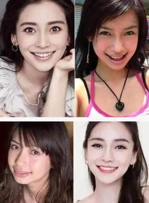 来看看明星整牙前后的对比!