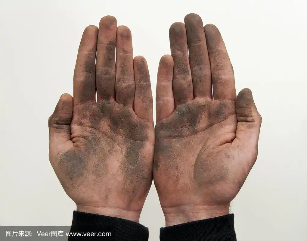 男人举起脏手,掌心朝上.