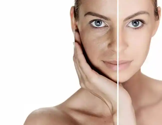 75促进胶原蛋白和弹性蛋白合成