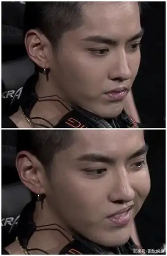 没这么近距离看过吴亦凡吧 连嘴上死皮都看得清 你看他像31岁?