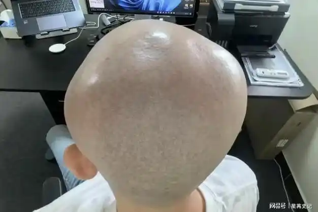 我说"推光头不太好吧,别人都害怕自己秃头,你倒好,还专门给自己推个