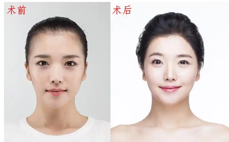 进阶女神你的发际线合格了吗