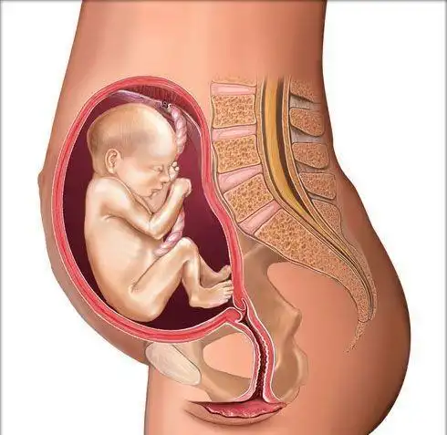 com/xysc/huaiyun/tefy/2到10个月,孕妇腹中胎儿胎位图(大图) http
