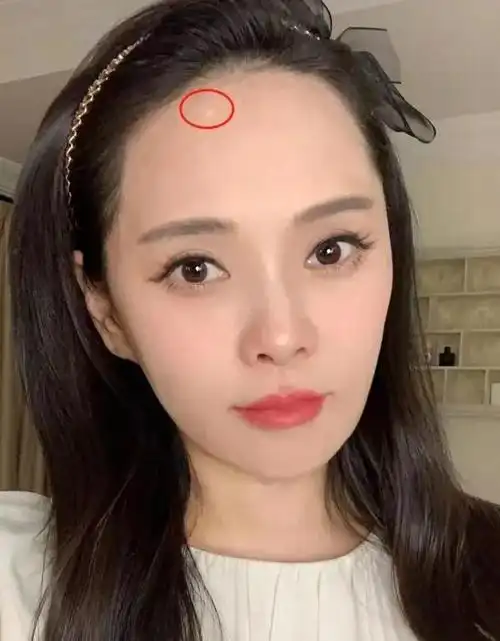 盘点割了双眼皮颜值飞升这7位女星切得太惊艳了判若两人