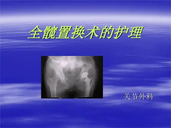 全髋置换术的护理[文字可编辑].ppt 50页
