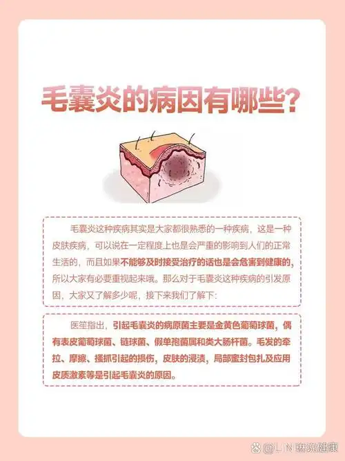 毛囊炎的病因有哪些?