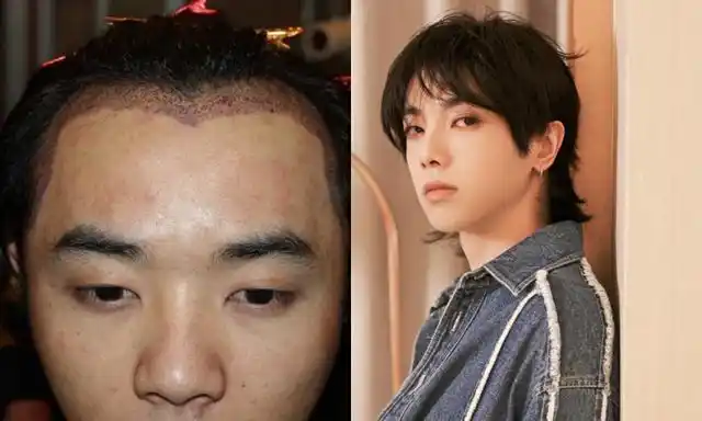 继在1月份官宣和张碧晨拥有一个孩子之后,华晨宇的路人好感度大跌