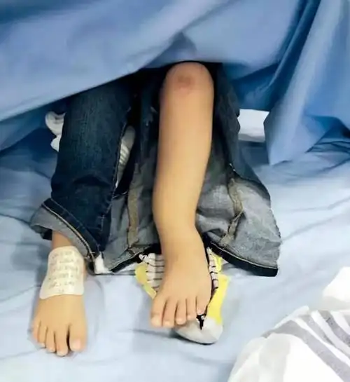 4岁女童跳弹床脚踝骨折_手机搜狐网