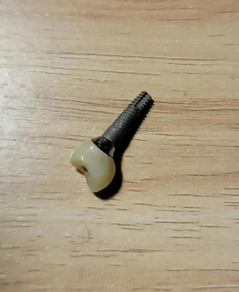 才知道原来种植牙的螺丝这么大个,这扎进去真的不痛吗,想想有点可怕啊