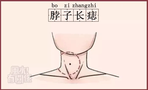 1,脖子长痣