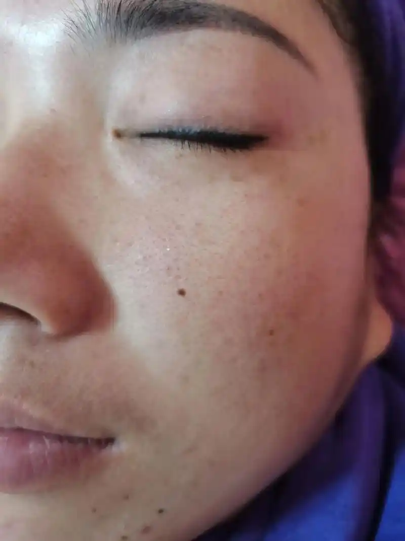 皮肤管理 #如何让皮肤变得细腻光滑 暖妍科技养肤,一次水光 - 抖音