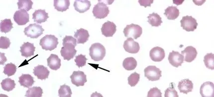 【有奖读图】常见形态学图片,你敢来参加考核吗?(第六期)