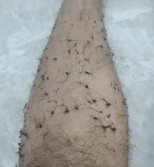 "腿毛太浓密不如打个结,看起来洋气不少!"哈哈哈天生自带毛裤