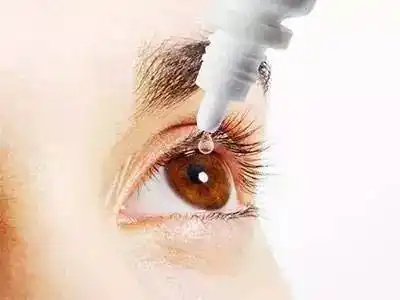 的食指和中指轻轻向下拨开下眼皮,右手持药瓶,将药水滴入眼睑1-2滴,再