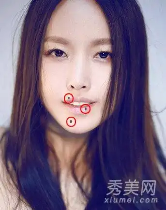 上唇有吉痣,代表不愁衣食,频繁可以享受美食,亦表示频繁有人请吃. .