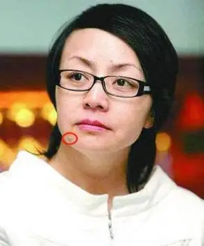 下巴突然长痣好不好(下巴突然长痣有什么寓意)