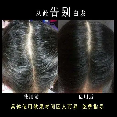 白发克星白头发变黑洗发水年轻年轻人人防育发中老年洗发水