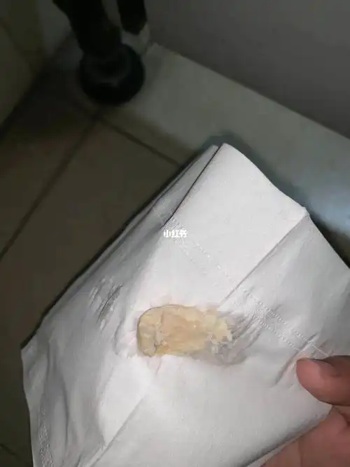 女性妇科炎症反反复复,生殖68系统长期不保养,就会导68致我们排毒