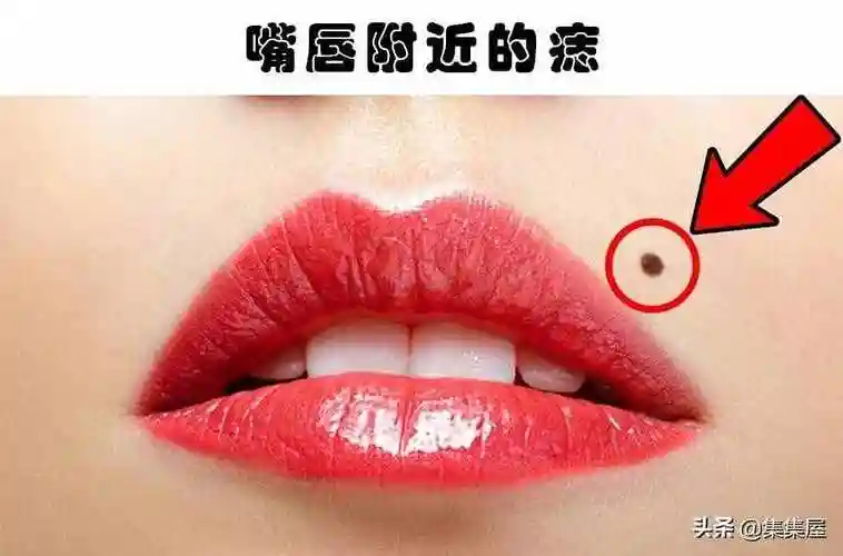 脸上痣的位置(看看身体上的7个位置的痣)