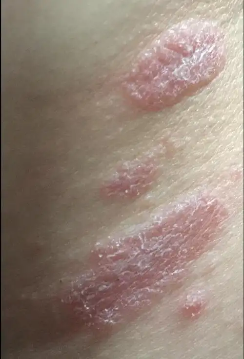 医生您好最近一周我脖子上有红斑和红点后来开始时不时的痒