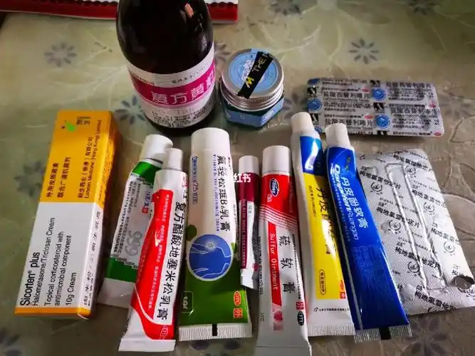 各种止痒药膏
