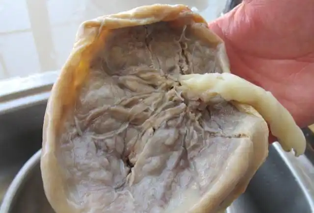 取出用凉水洗无数次,一定要把里面的血冼干净为止,处理后的胎盘是白色