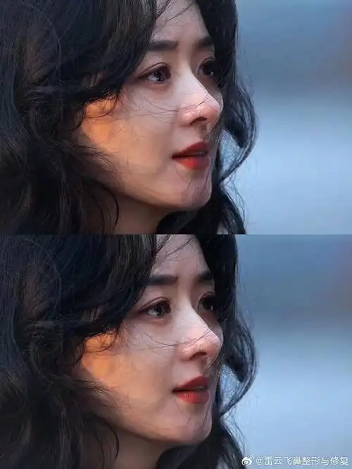 赵丽颖##武汉隆鼻##今日美貌营业