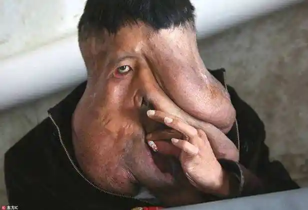 丑人照片图片真实 丑人图片照片真人搞笑_布阁拉