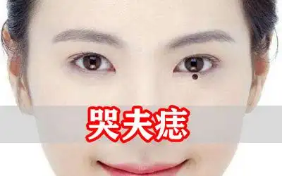 哭夫痣是什么意思和泪痣的差别