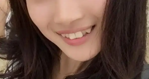 长虎牙的女孩有福气吗虎牙女生克夫还是旺夫