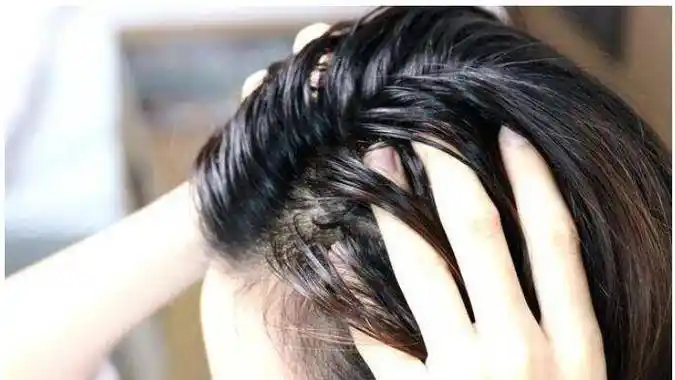 头发爱出油怎么办给你四招