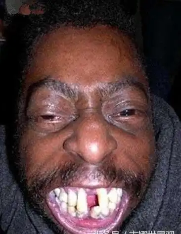 直击全球最丑10大男性,7个非洲,1个印度,竟然全都有老婆!