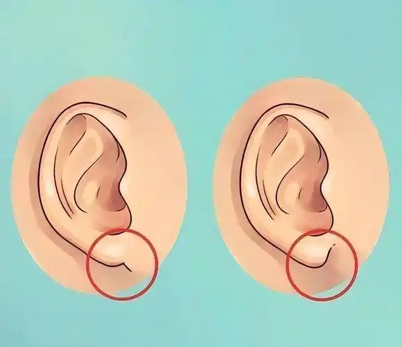 下嘴唇厚的女人面相_耳垂下长痣女人面相_下嘴唇长的女人面相好吗?