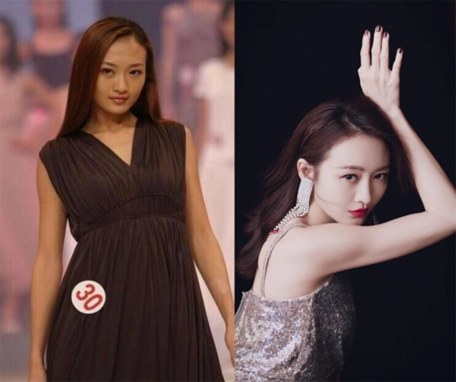 明星出道前vs后差别大,王鸥张雨绮还好,沈梦辰这是换脸了?