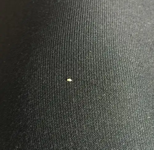  追问 发根有白色颗粒