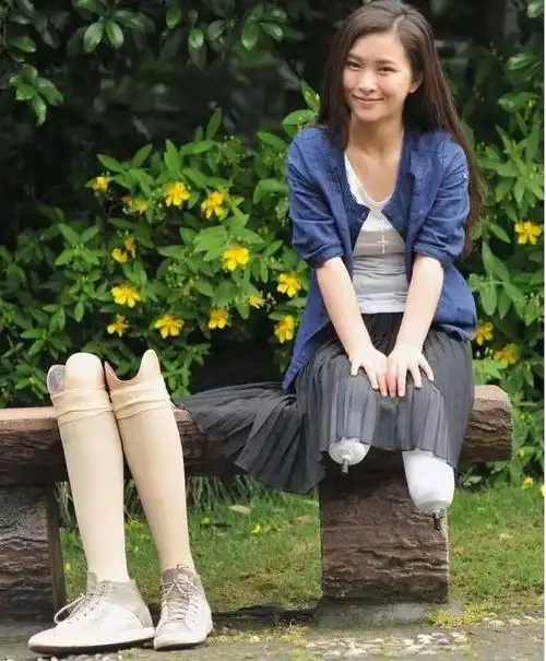 遭遇地震她被困30个小时获救后双腿截肢惨被丈夫抛弃现况如何