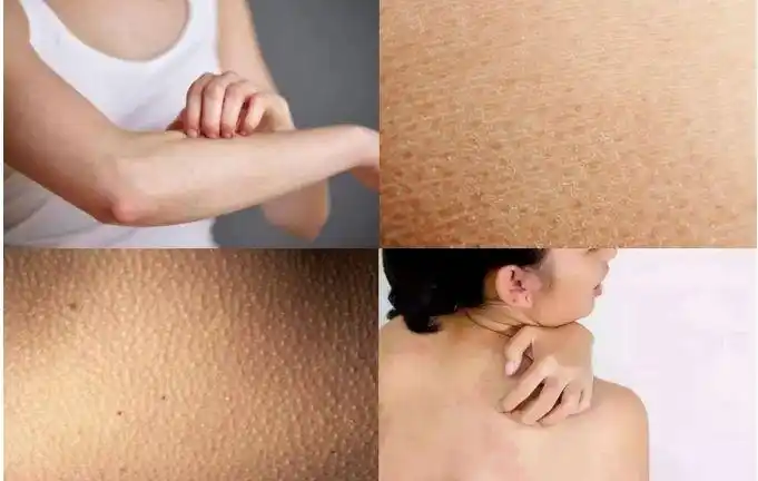 团购│开春皮肤干燥,脱皮,发痒?用了它,我都想睡了我自己!_肌肤