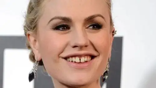 9位牙齿最难看的超级明星