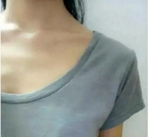 平胸大赛冠军投诉/报错