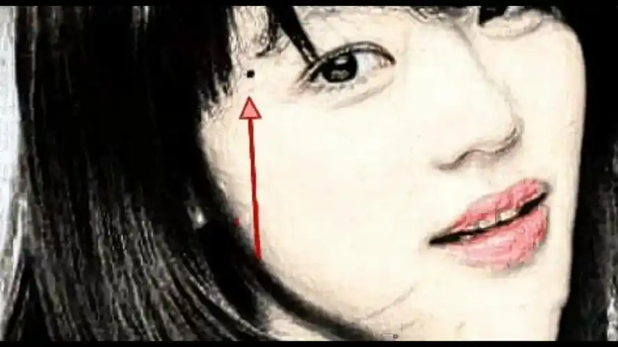 女人脸上三处恶痣,不能留,刑克伴侣,易二婚或多婚!