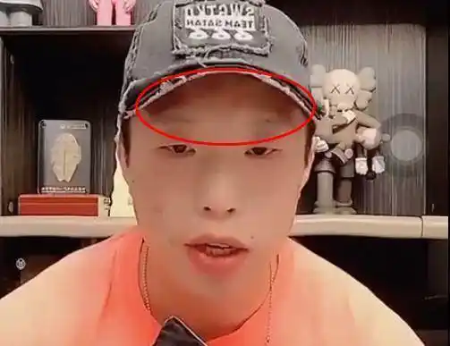 因为美颜开得太厉害,结果把眉毛都给磨没了_孟鹤堂_比赛_相声