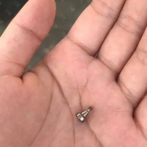 种植牙螺丝也能掉出来吓傻我了