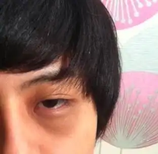 黑眼圈词条图册_百度百科