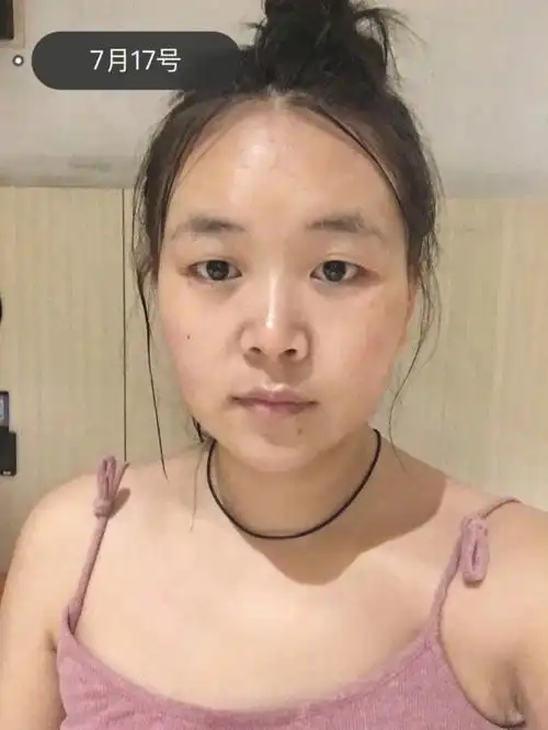 运动一个月脸部变化有多大