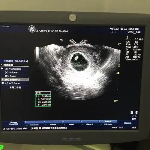 宝宝的第一张照片看到胎心胎芽啦好迷你