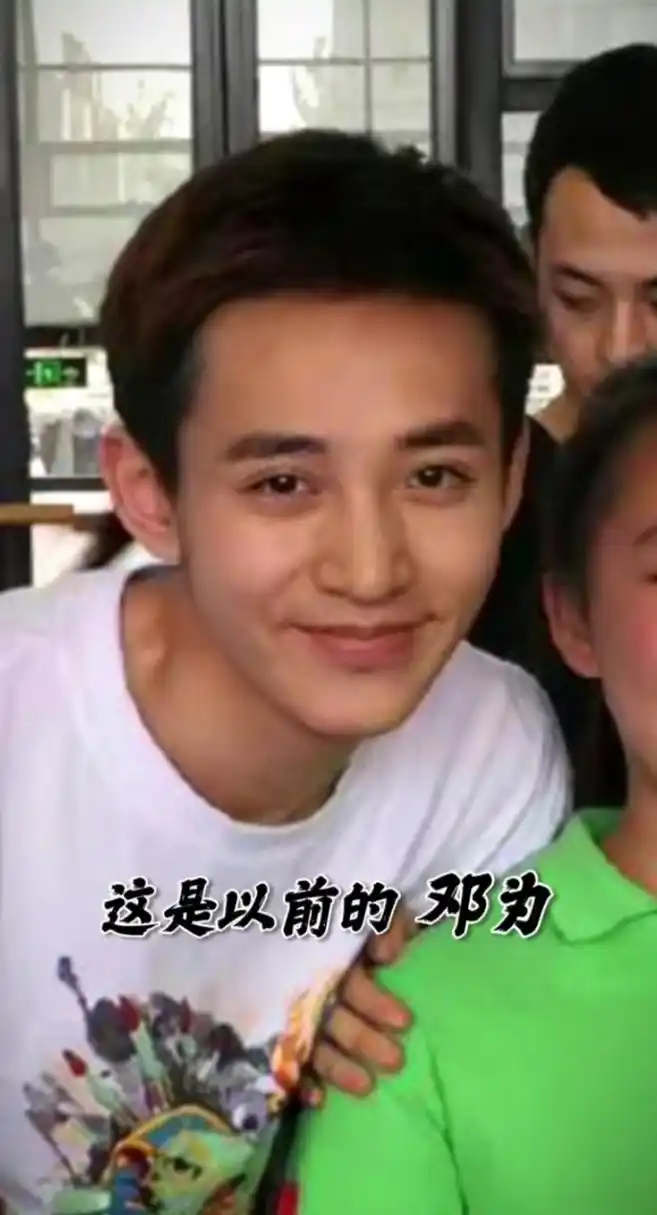 网友质疑邓为整容,素人时期和现在颜值差距超大.