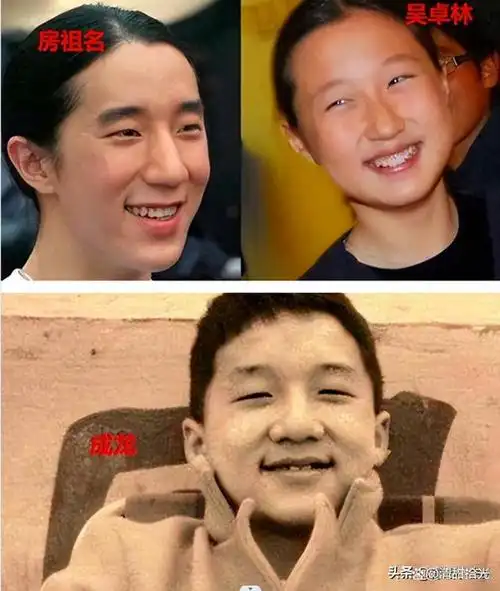 成名前的成龙是单眼皮,而且个头比较胖,可能是做了双眼皮手术.