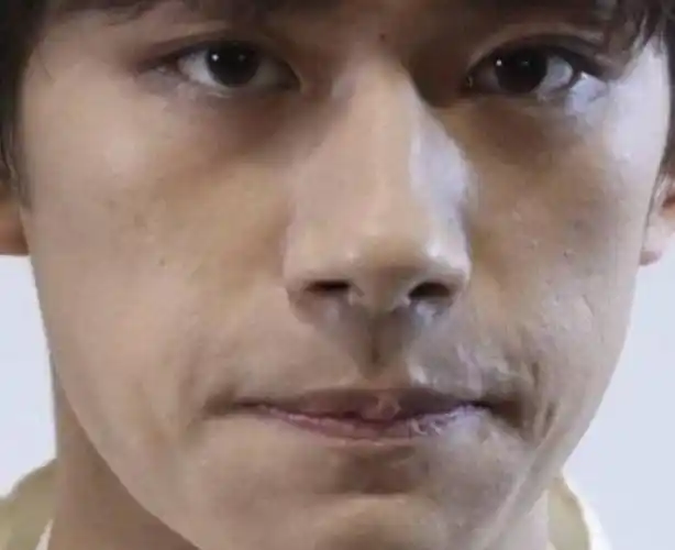 易烊千玺生图被疯传,无美颜下皮肤坑坑洼洼,粉丝差点以为看错了