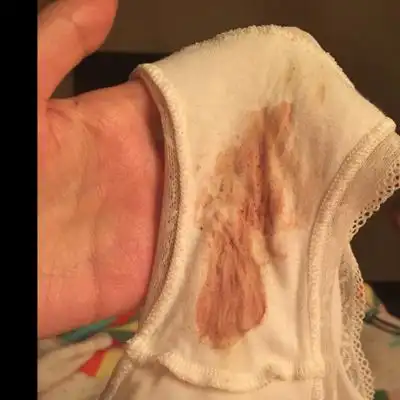 问答 怀孕期 推荐回答                      这个是出血了,要去医院