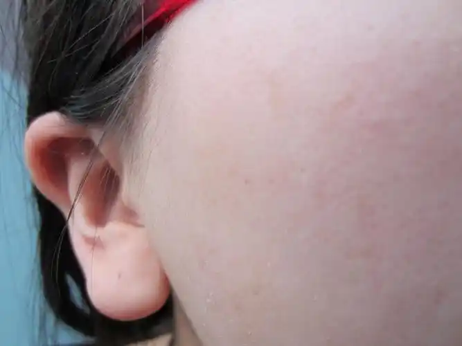 (宝洁:第一张是我洁面后,个人皮肤属于混合型偏干 -蘑菇街